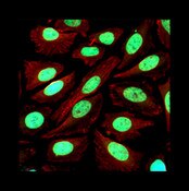 IF of Hela cells stained with DSHB antibody CPTC-KRT Group A-1against KRT (green), anti-microtubules (red), and DAPI (blue). Image credit: Clinical Proteomics Technologies for Cancer